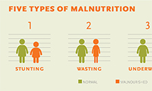Thumb of five types of malnutrition diagram
